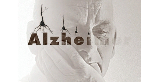 alzeifa
