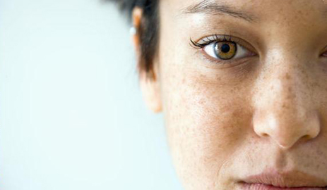 Paralisia Facial